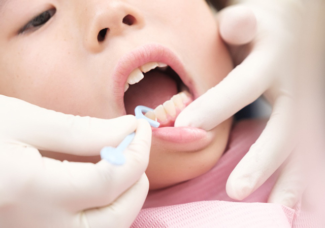 【歯科医師に聞いてみた】子供の健康な歯を維持するための、上手な歯磨き方法を教えてください！